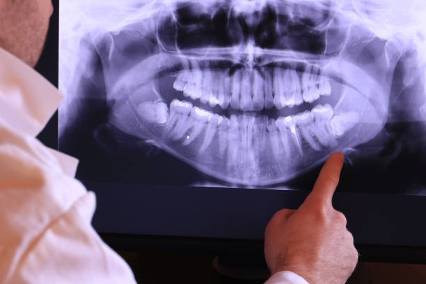 Best Emergency Dental Care for Broken or Chipped Teeth in Riverse, ID