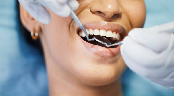 Best Weekend Emergency Dentist in Riverse, ID